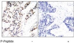 ER alpha/NR3A1, p Ser106 Antibody, Novus Biologicals 0.025 mL; Unconjugated:Antibodies,